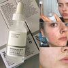 Niacinamide 10% + Zinc 1% With Batch Code The Ordinary Serum