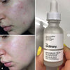 Niacinamide 10% + Zinc 1% With Batch Code The Ordinary Serum